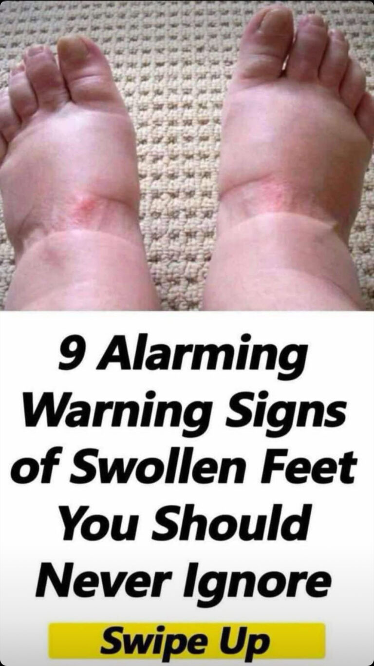 There are nine scary warning symptoms of swollen feet that you should never overlook